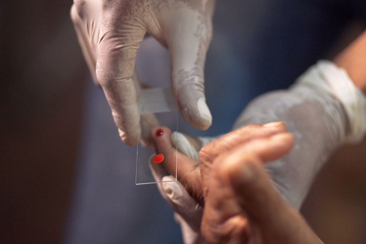 Com queda de 26%, Brasil vive novo cenário no combate à malária